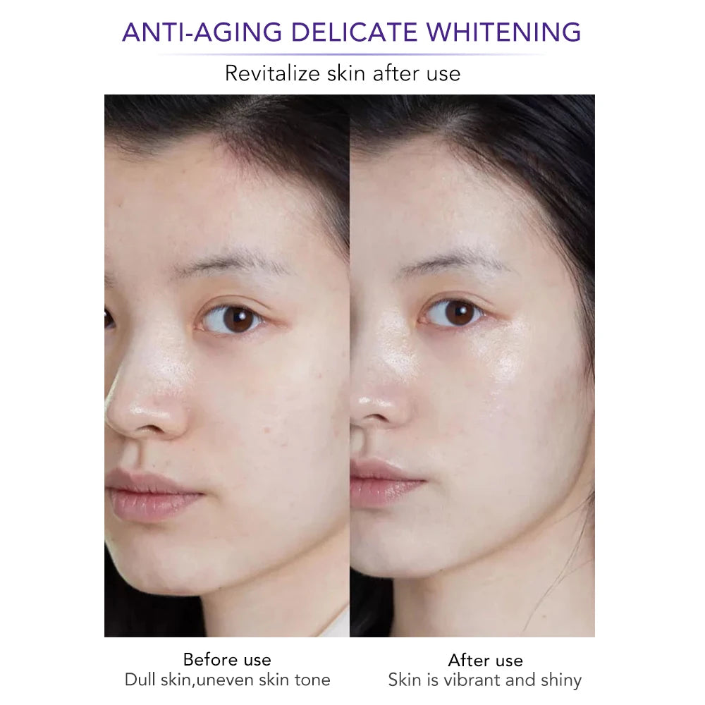 AILKE Face Cream With Hyaluron Scars Whitening Moisturizing Lifting Anti-aging Women Sleeping Dry Korean Bleaching Skin Care